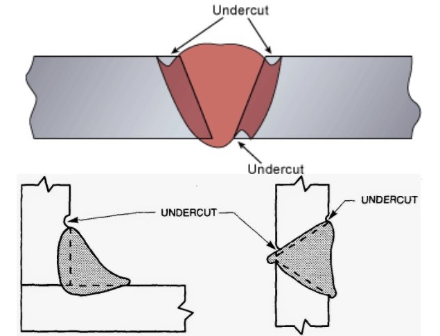 Cacat Las Undercut