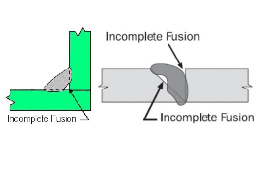 Cacat Las Incomplete Fusion